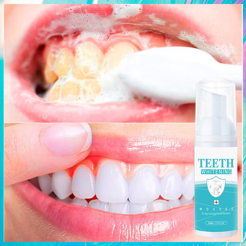 👨‍⚕TEETH WHITENING MOUSSE🔥