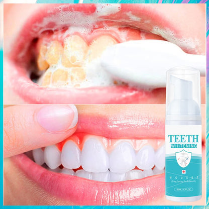 👨‍⚕TEETH WHITENING MOUSSE🔥